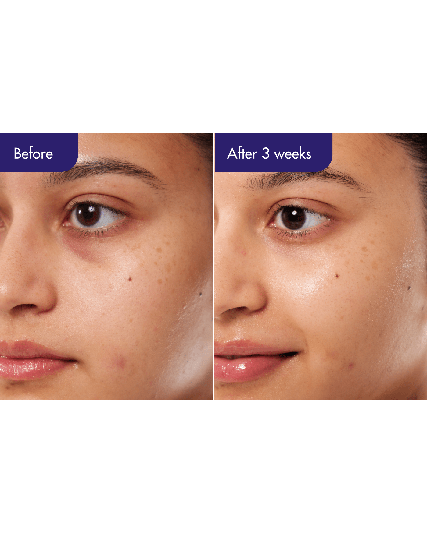 PDRN Caffeine Shot Serum